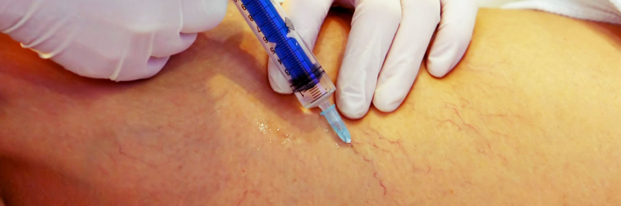 Lipo sem Corte